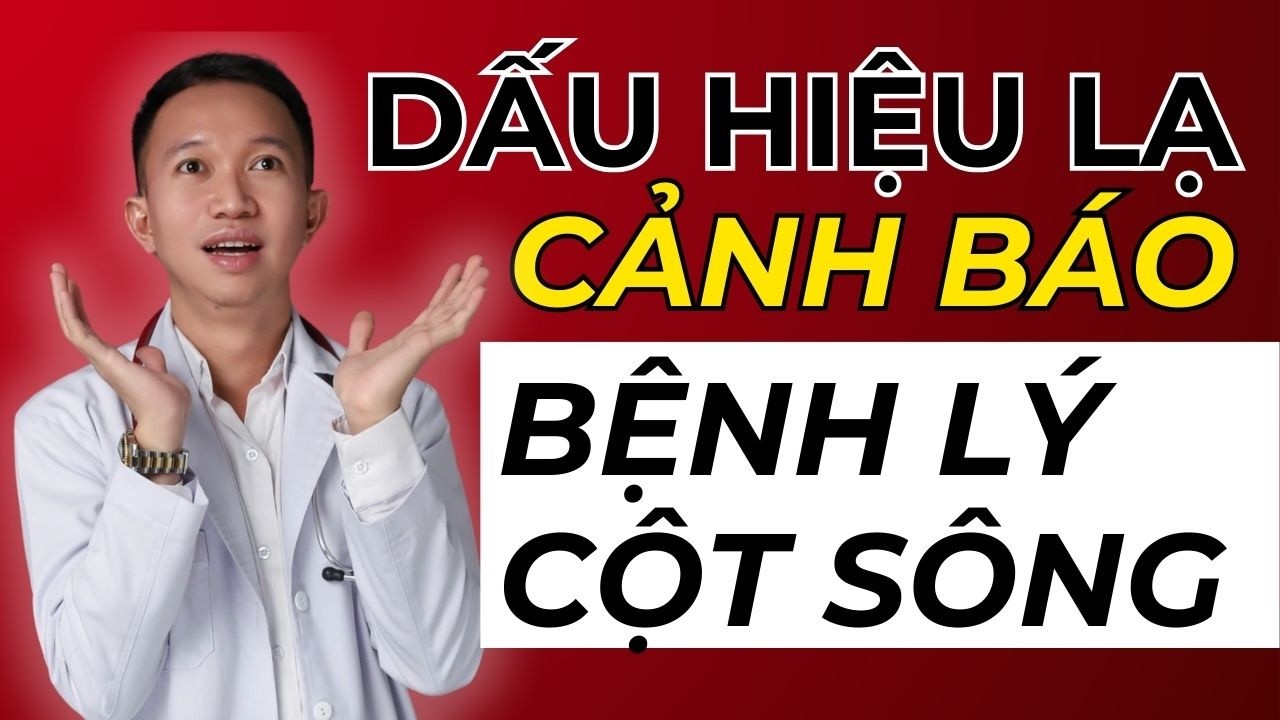 Dấu hiệu cảnh báo bệnh lý cột sống | Bác Sĩ Trần Minh