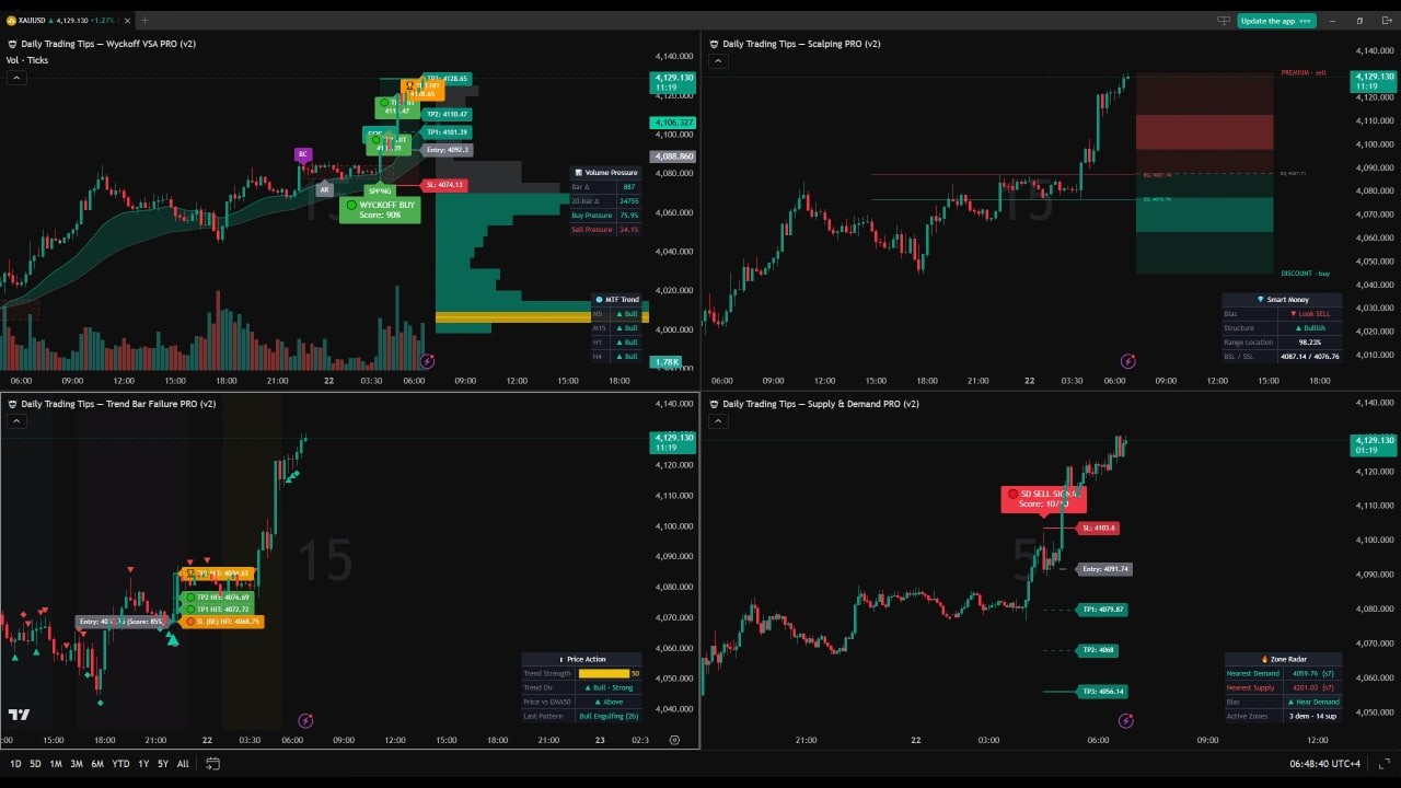 🔴 LIVE 24/7 GOLD SIGNALS – XAU/USD Market Analysis | Daily Trading Tips!