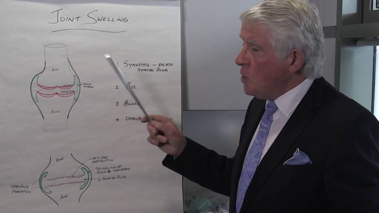 2- Understanding joint swelling