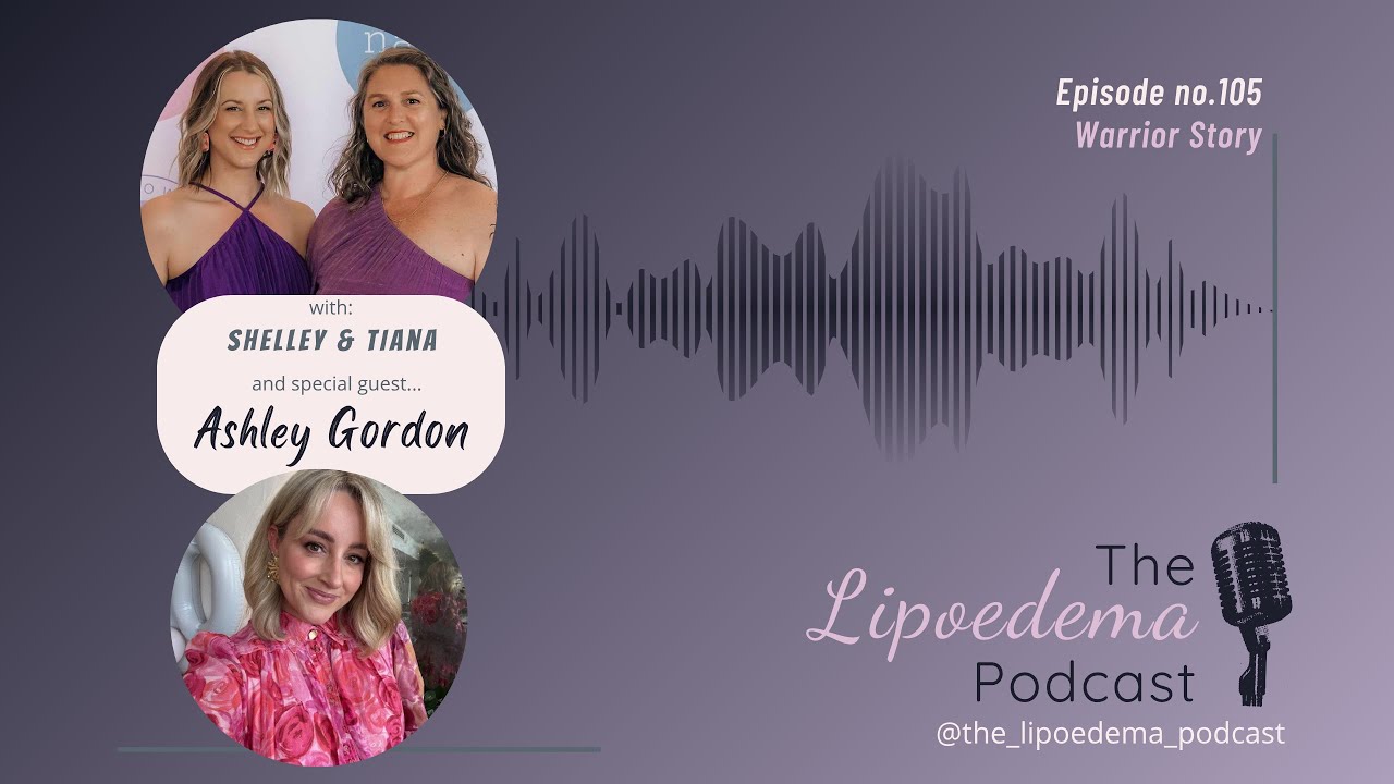 Ep. 105 ~ Lipoedema Warrior Ashley Gordon