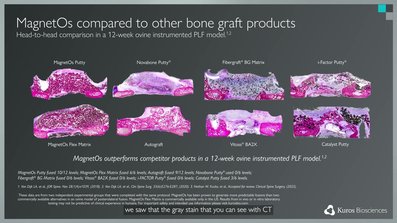 How does MagnetOs compare to other commercially available bone grafts on the market?