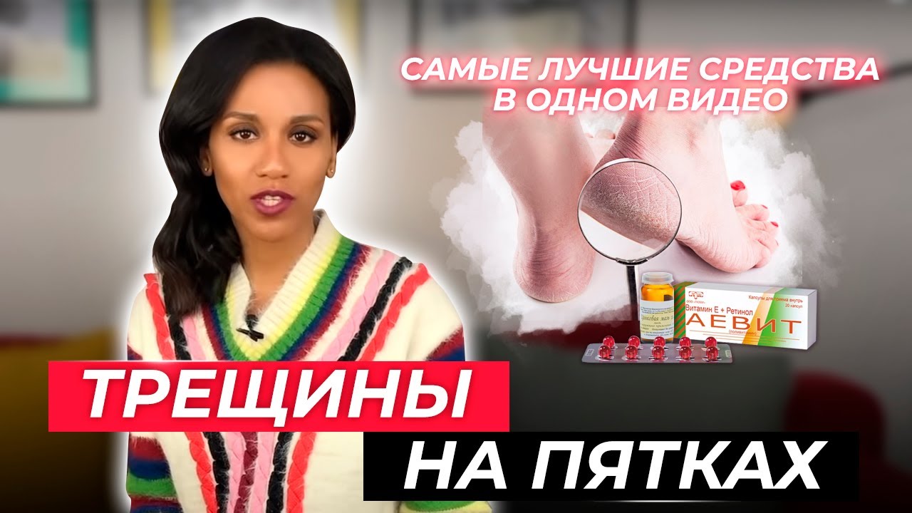 Избавьтесь от трещин на пятках раз и навсегда// Трещины на пятках до и после 50лет// Лучшие средства