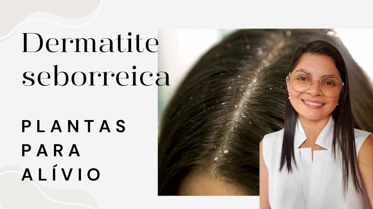 Dermatite Seborreica, plantas para melhorar