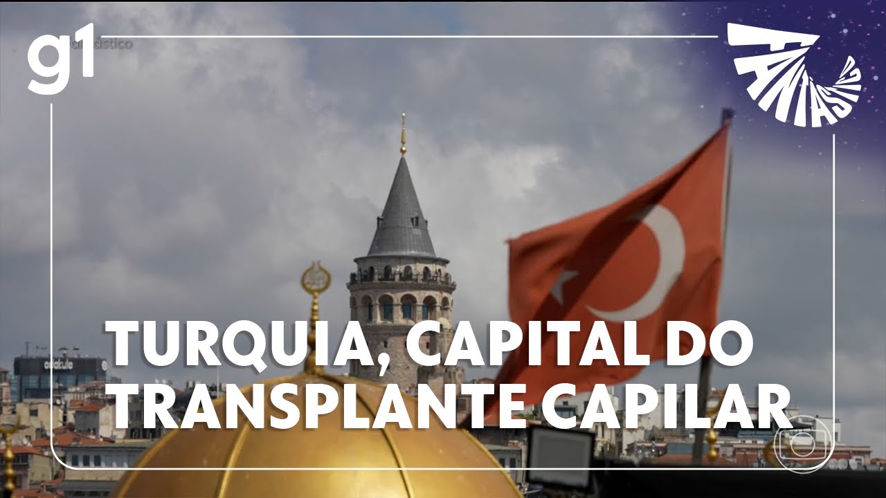 Fantástico: Turquia vira capital mundial do transplante capilar e atrai pacientes de todo o mundo