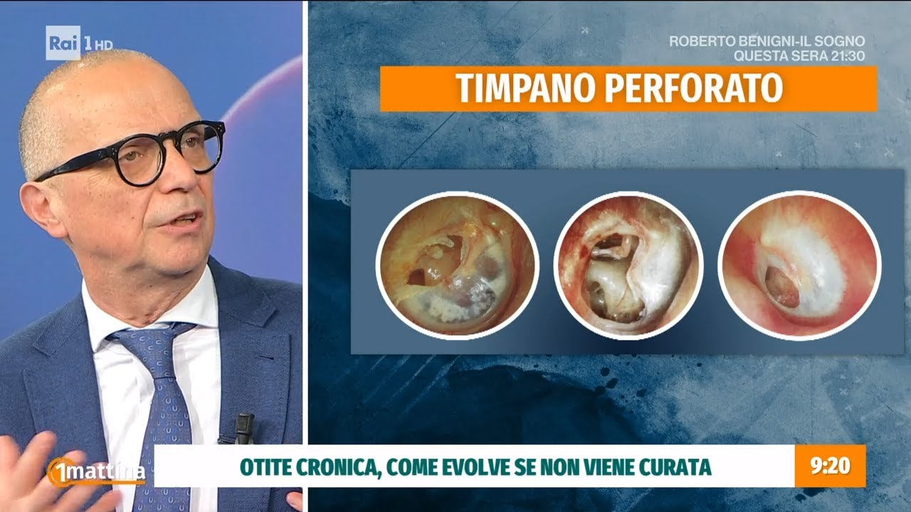 Otite esterna e otite media: come riconoscerle - Unomattina 19/03/2025