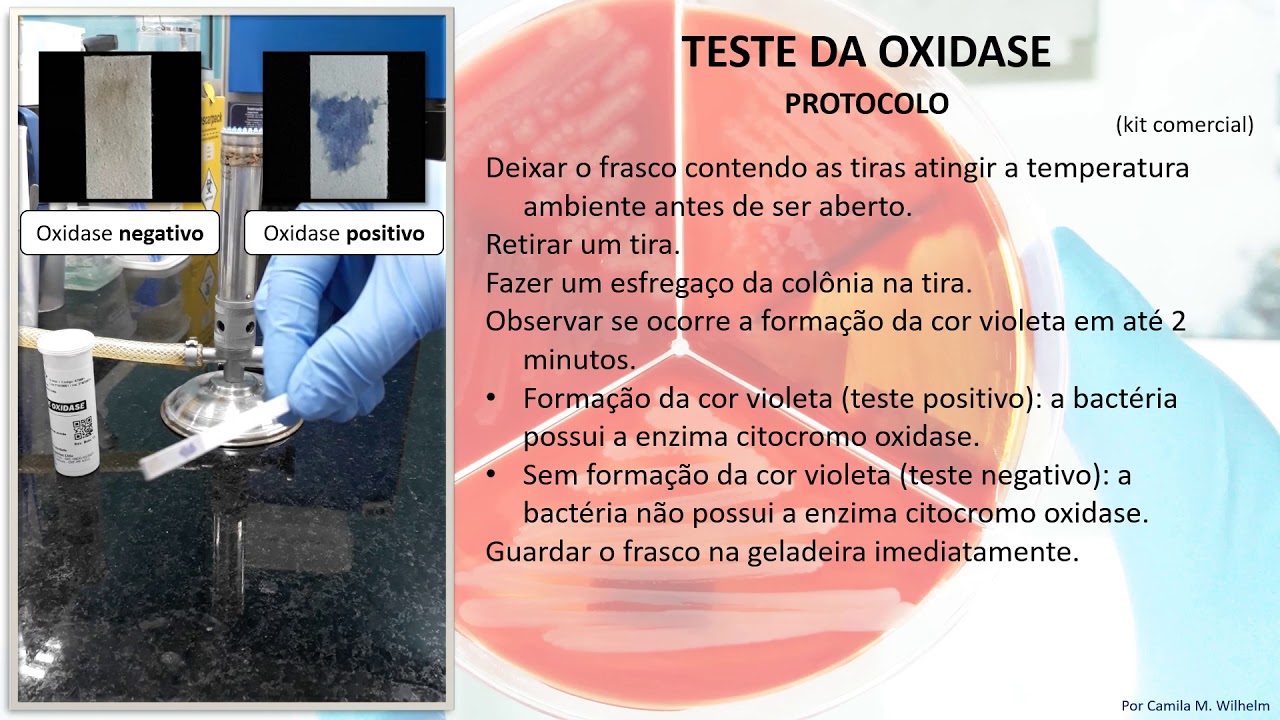 Teste da oxidase