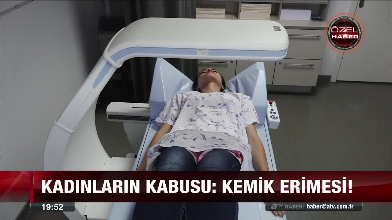 Kemik erimesinin belirtileri nelerdir? - 31 Ocak 2018