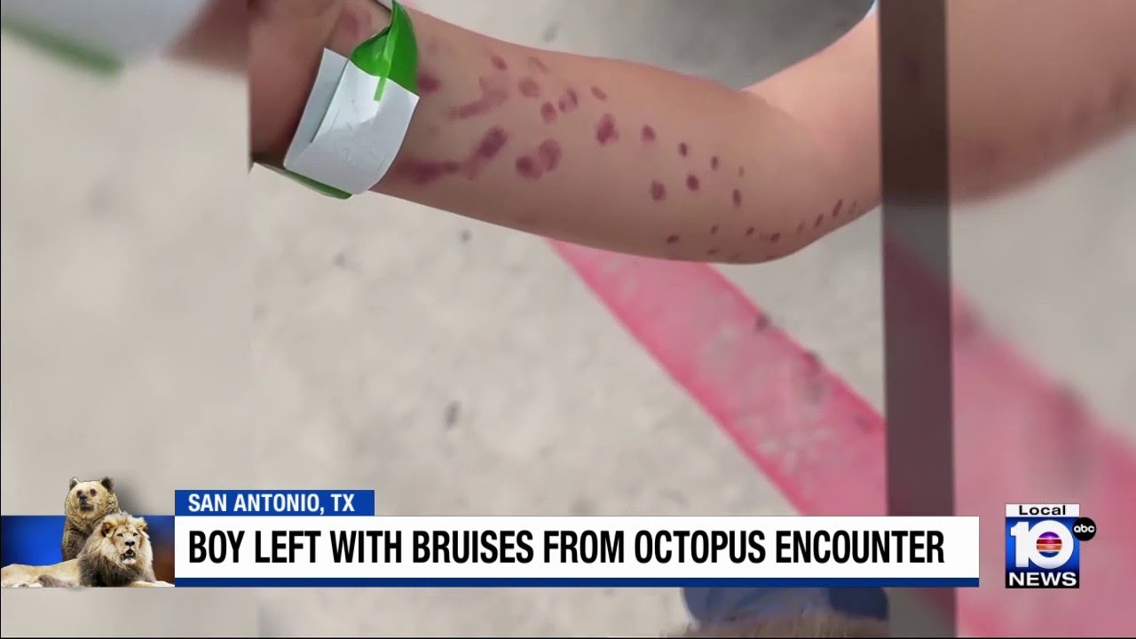 Boy injured after interaction with octopus at San Antonio aquarium