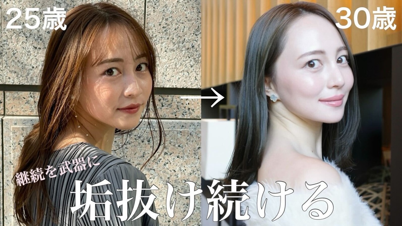 【最新版】垢抜けた理由20選✨やってよかった美容医療＆自宅美容を全部紹介！