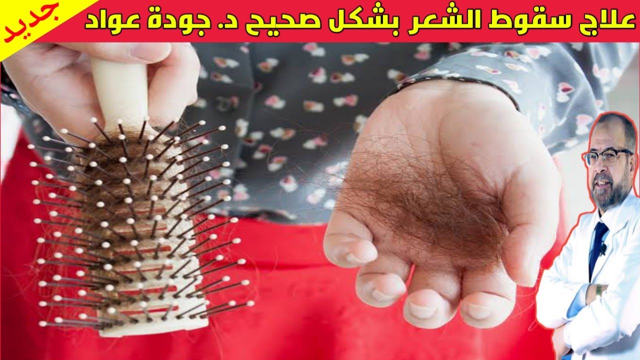 علاج سقوط الشعر بالشكل الصحصح - دكتور جودة محمد عواد | دكتور جودة محمد عواد