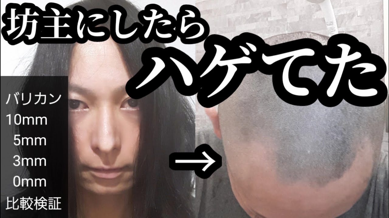 ロン毛から坊主にしたらハゲてた…。バリカンカット長さ比較。そしてスキンヘッドへ…