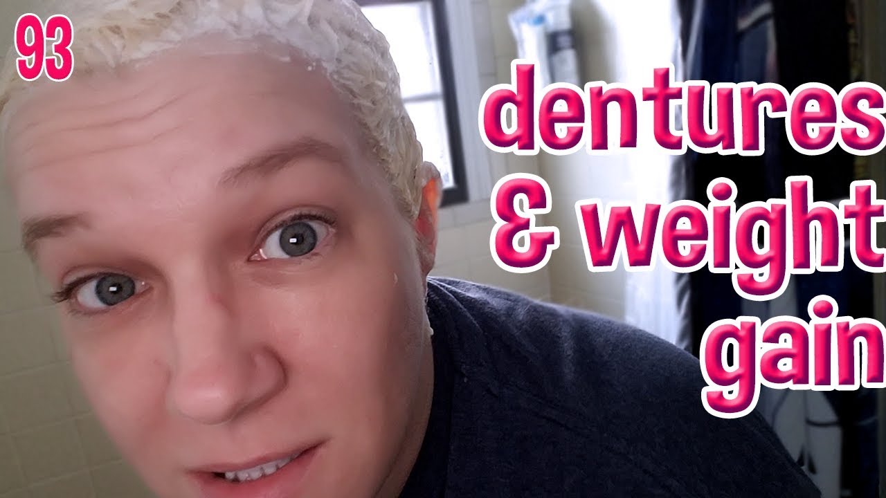Dentures and Weight Gain