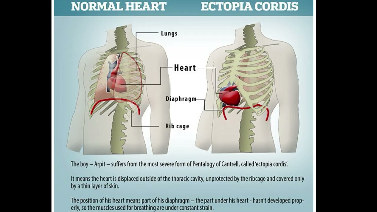 Lymphatic system