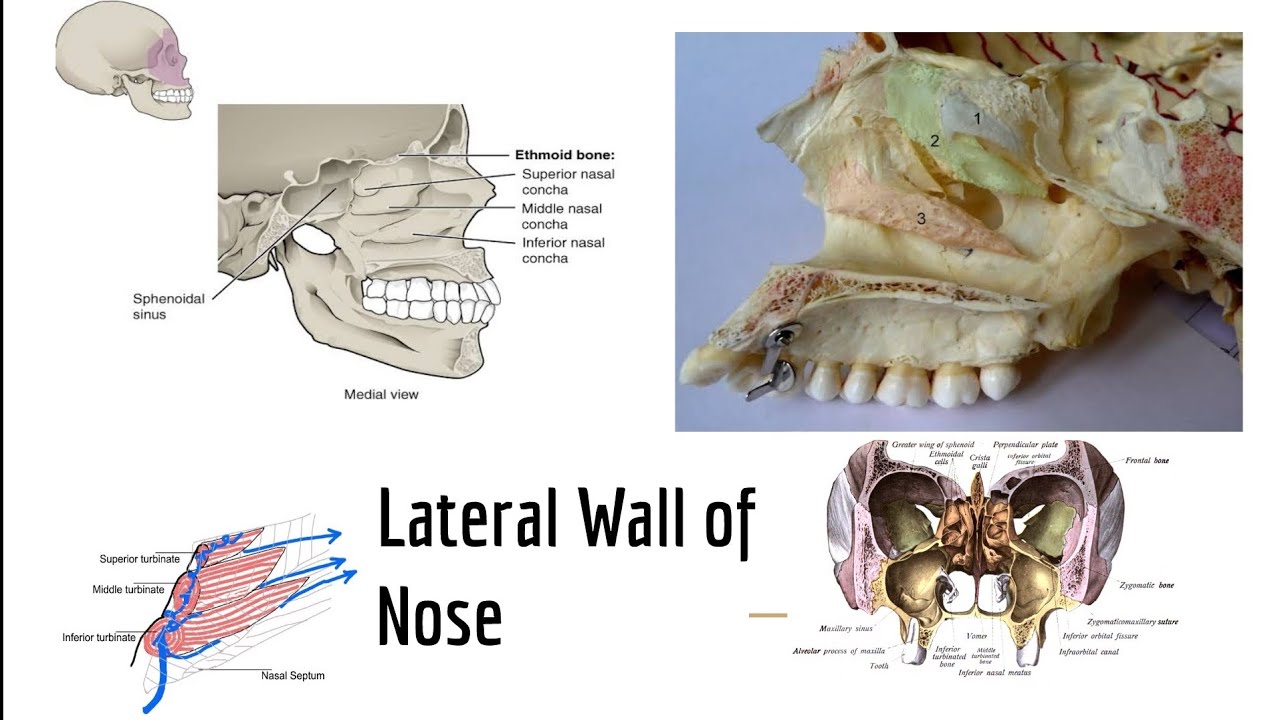 Lateral wall of nasal cavity