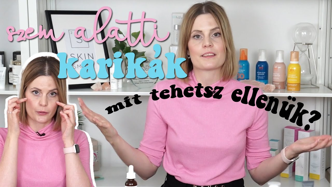 Sötét karikák a szem alatt – mit tehetsz ellenük?
