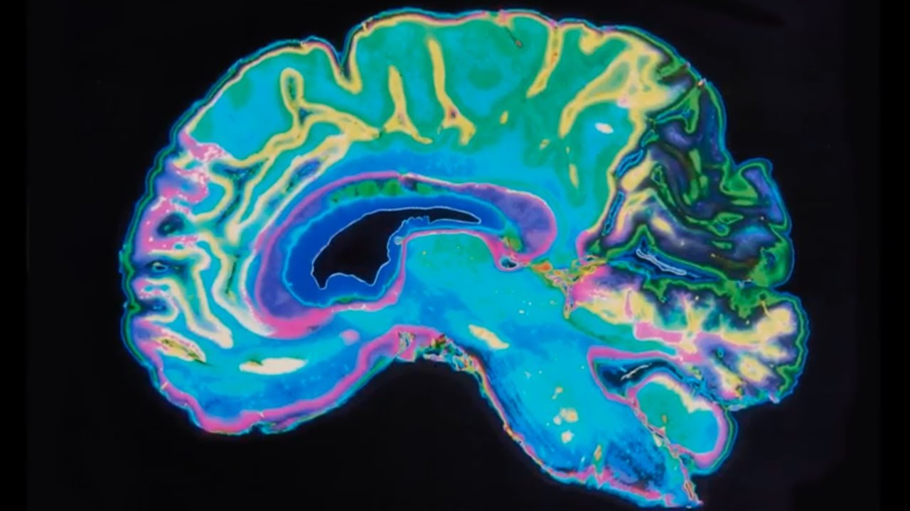 UT Austin: Leading A Brain Health Revolution