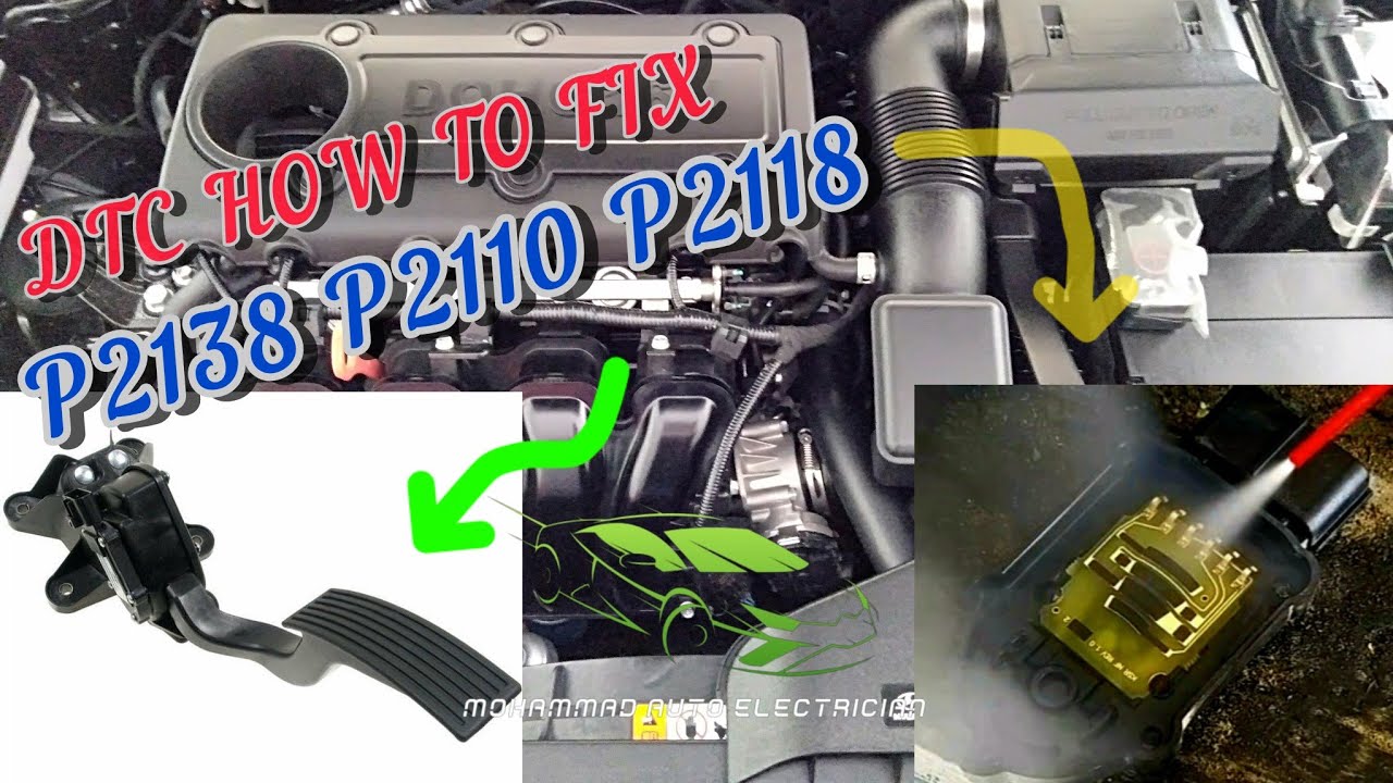 DTC P2138 P2110 P2118 || HYUNDAI SONATA || Accelerator pedal not working || गाड़ी की ऐसेलेटर काम नही