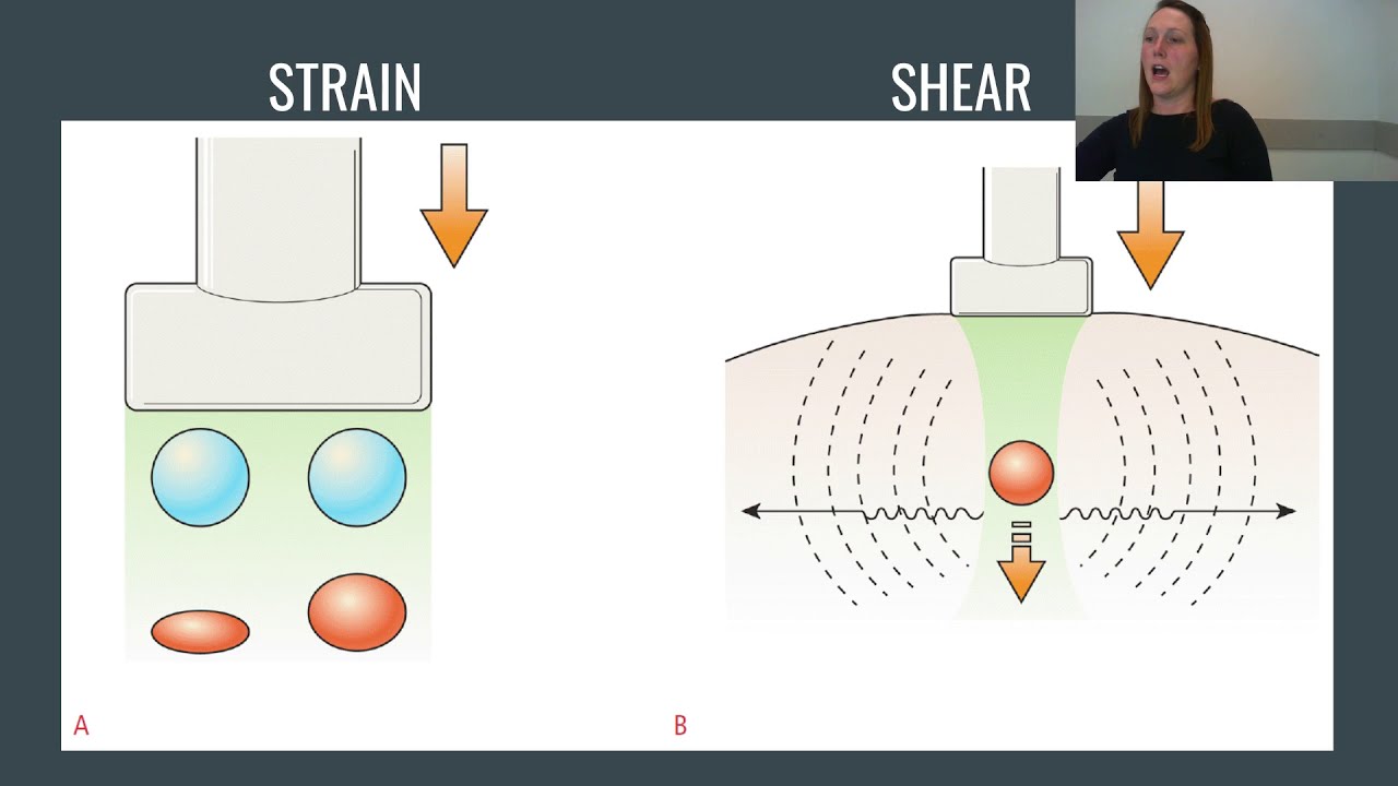 Ultrasound Elastography Explained: Strain and Shear