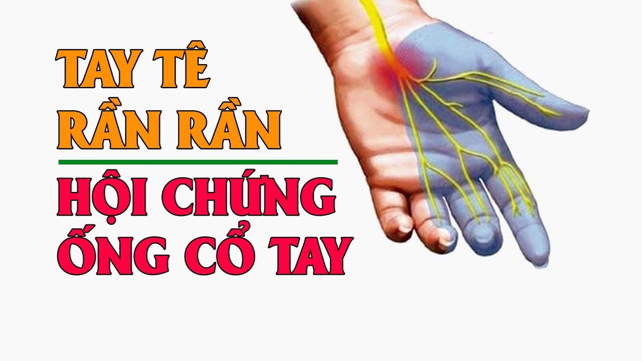 Hội chứng ống cổ tay chữa trị thế nào?