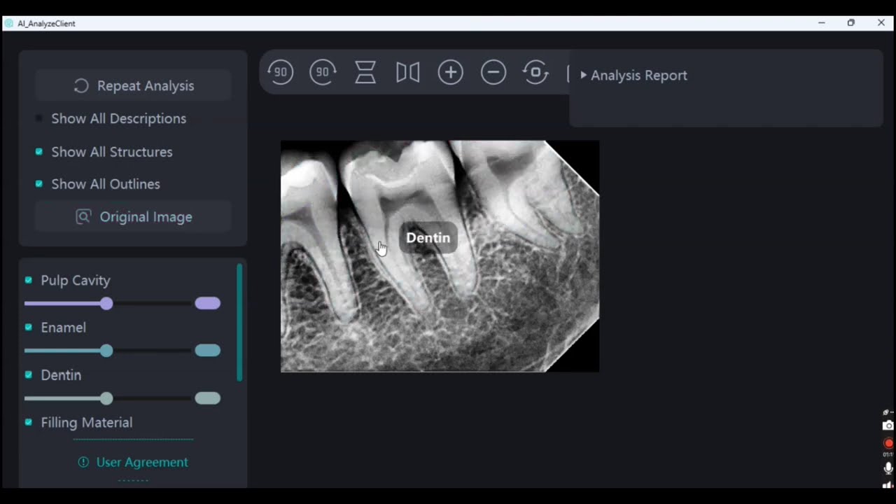 Revolutionizing Dental Care With AI Powered k sensor for Diagnosis & Documentation Software