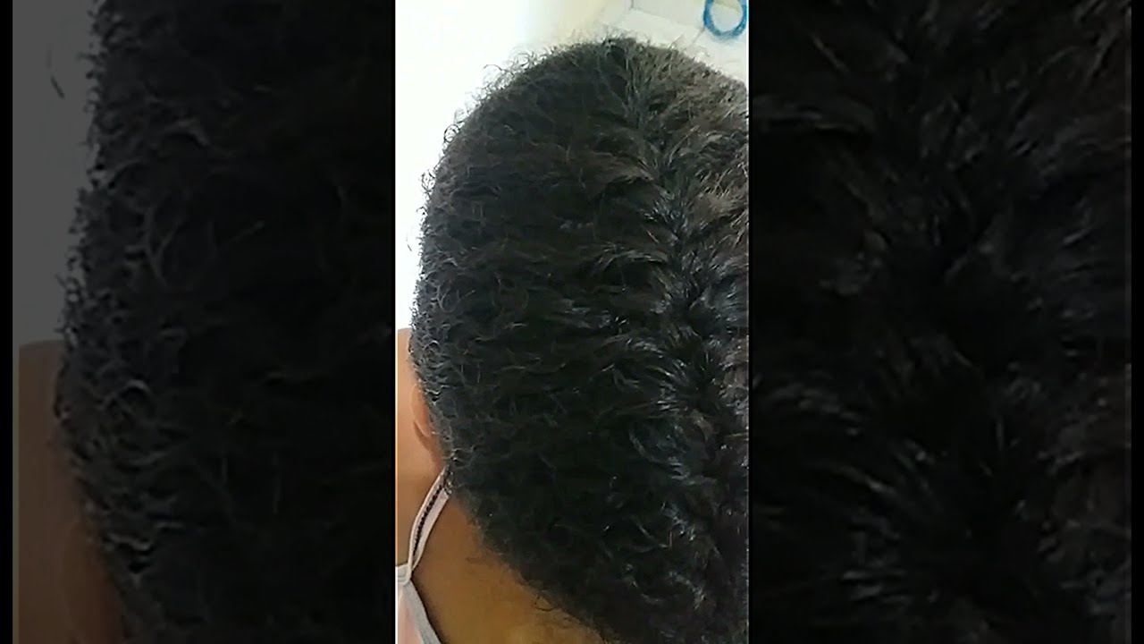 Tran&ccedil;a escama de peixe!    
