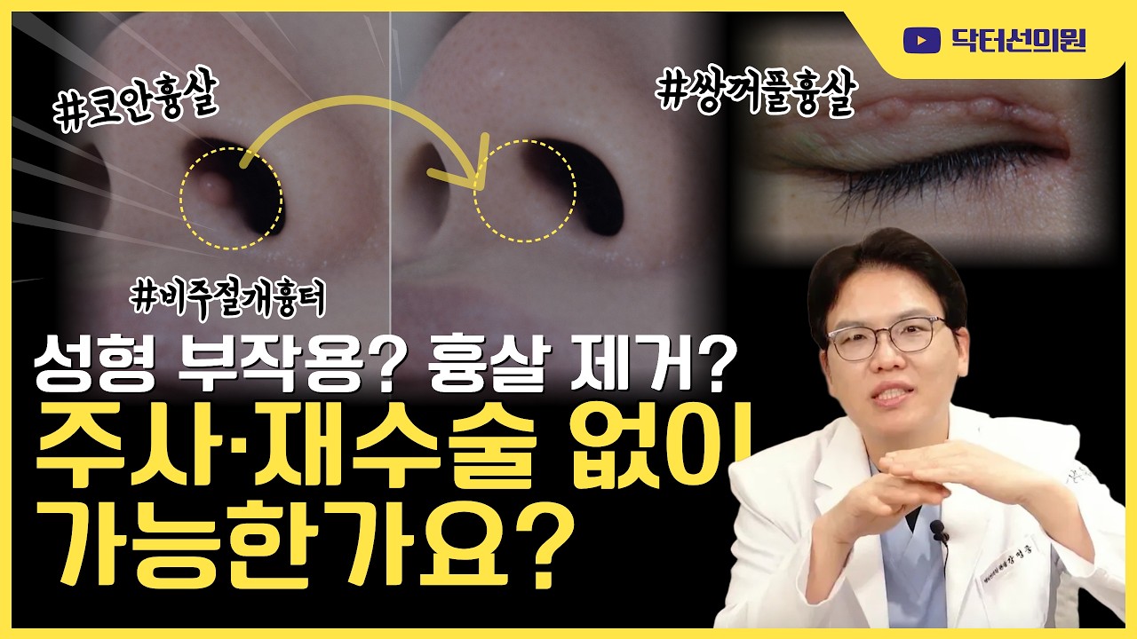 코 흉살 , 쌍수 앞머리 흉살 고민? 흉살 주사 재수술 없이 없애는 방법!