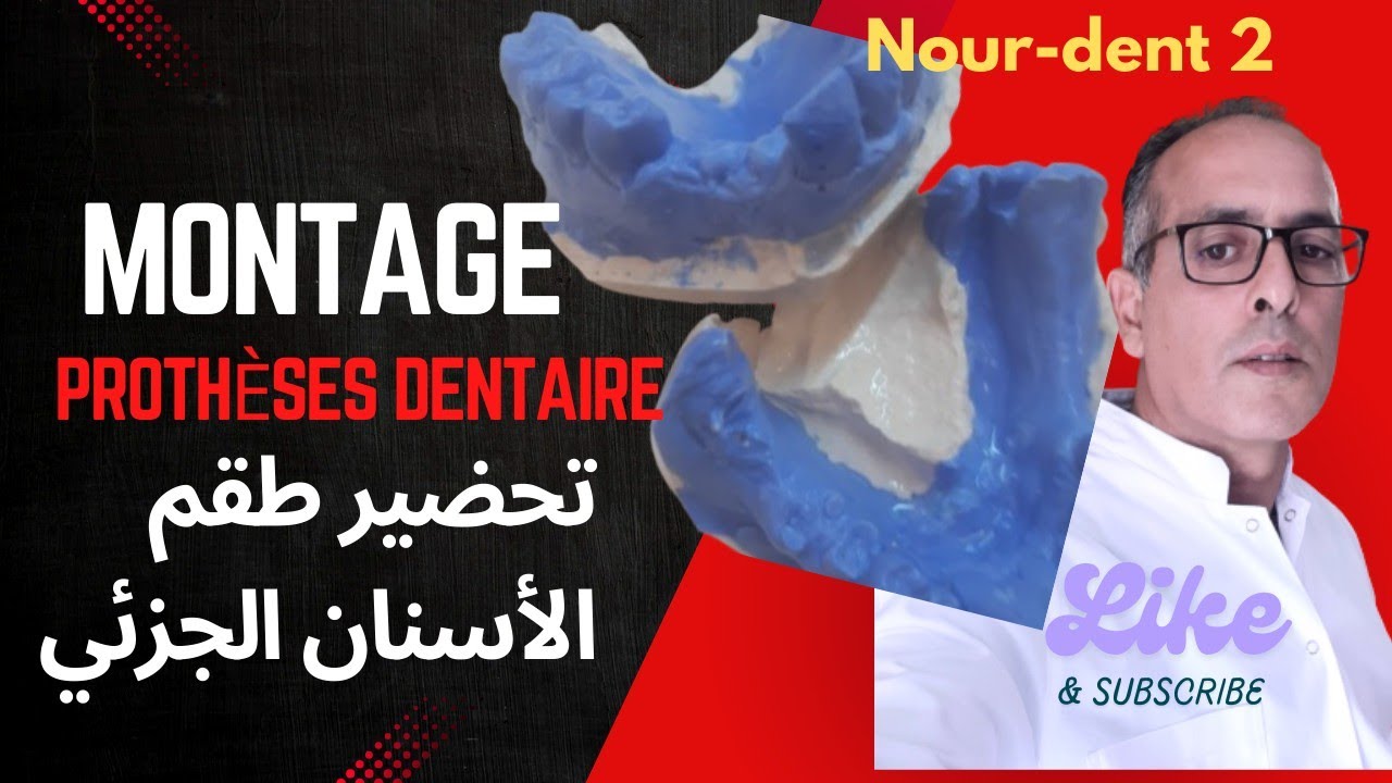 Montage proth&egrave;se dentaire haut. تحضير طقم الأسنان الجزئي @Nourdent