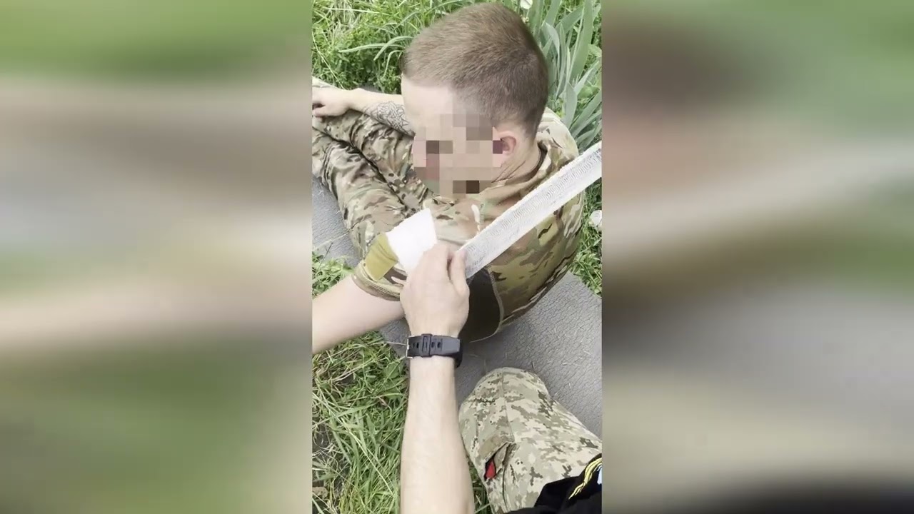 Вузлові кровотечі. Massive bleeding