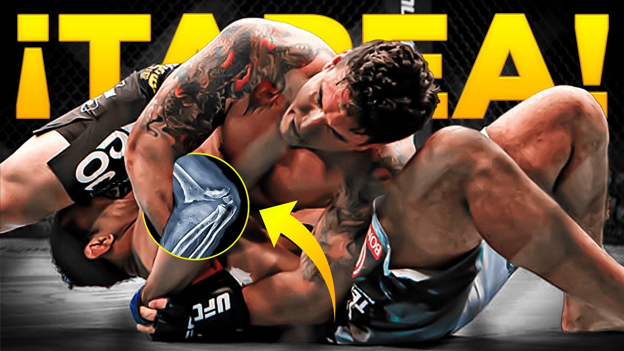 3 de las LESIONES m&aacute;s BRUTALES de las MMA