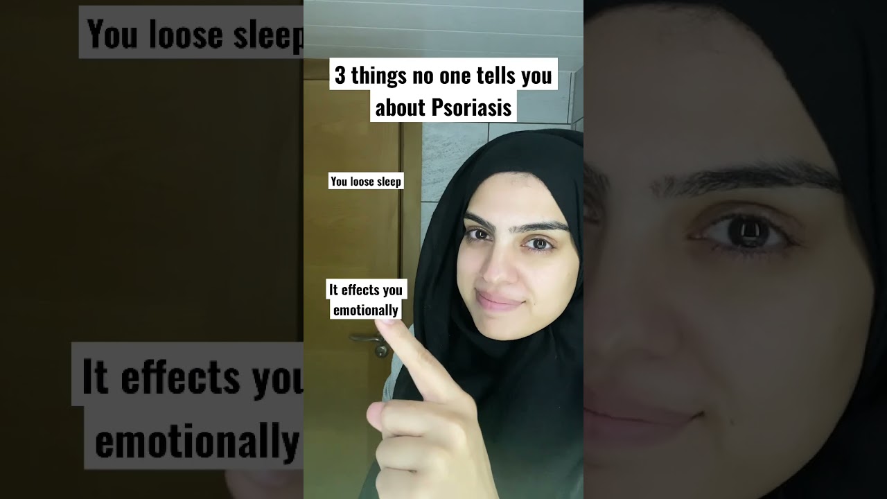 3 things no one tells you about Psoriasis #psoriasisawareness #psoriasis #dryskin #autoimmune