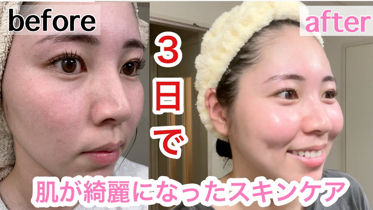 新大久保で買ったスキンケア商品が凄すぎた