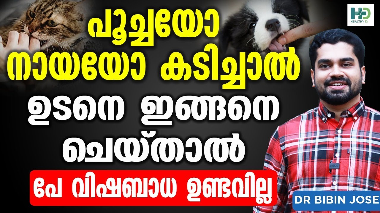 പൂച്ചയോ നായയോ കടിച്ചാൽ  ഇങ്ങനെ ചെയ്തില്ലെങ്കിൽ പേവിഷബാധ ഉണ്ടാവും| Poocha Manthiyal Enthu cheyyanam