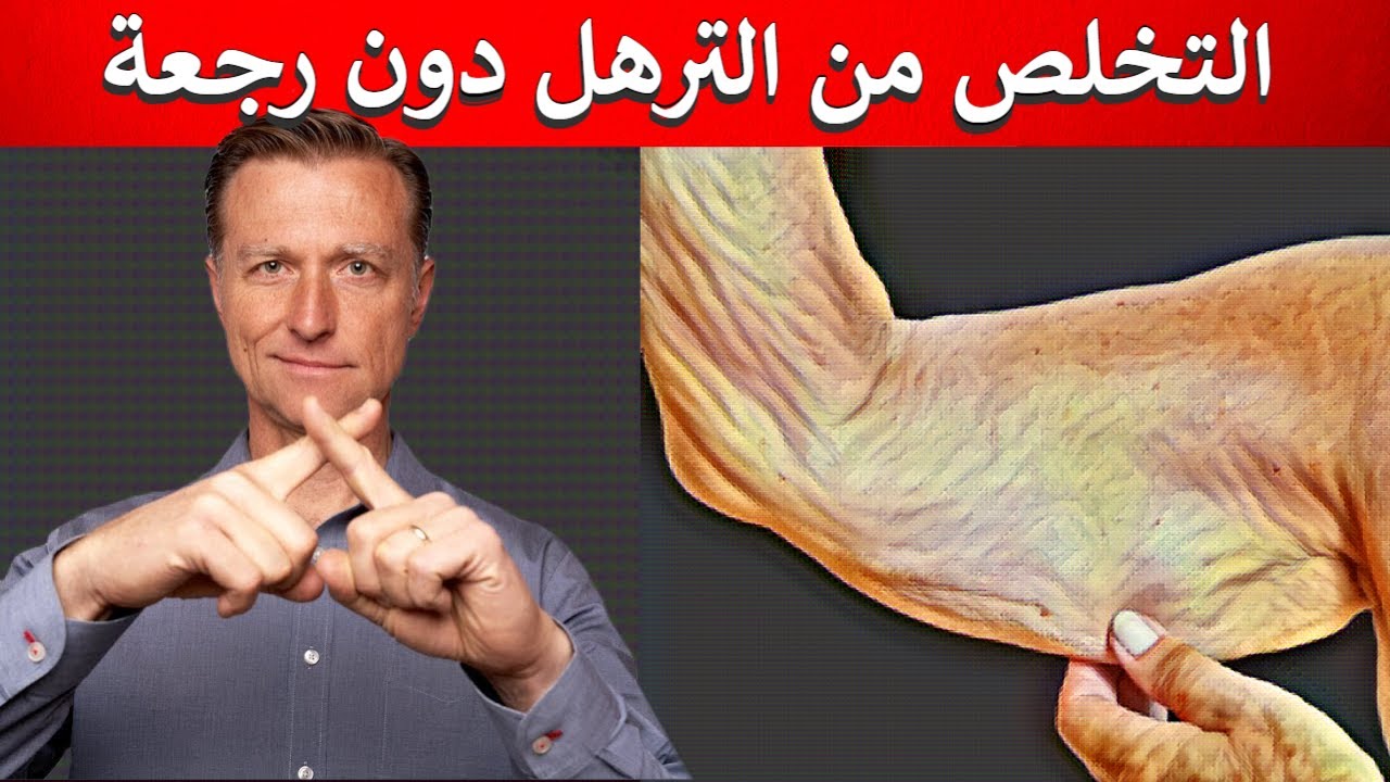 الترهّل | أفضل طريقة لإبقاء الجلد مشدود دون ترهلات