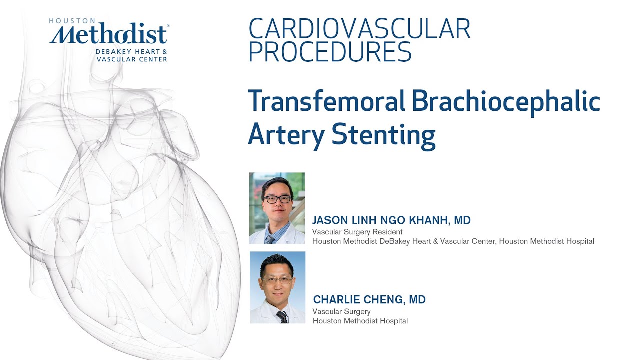 Transfemoral brachiocephalic artery stenting (Jason Linh Ngo Khanh, Charlie Cheng, MD)