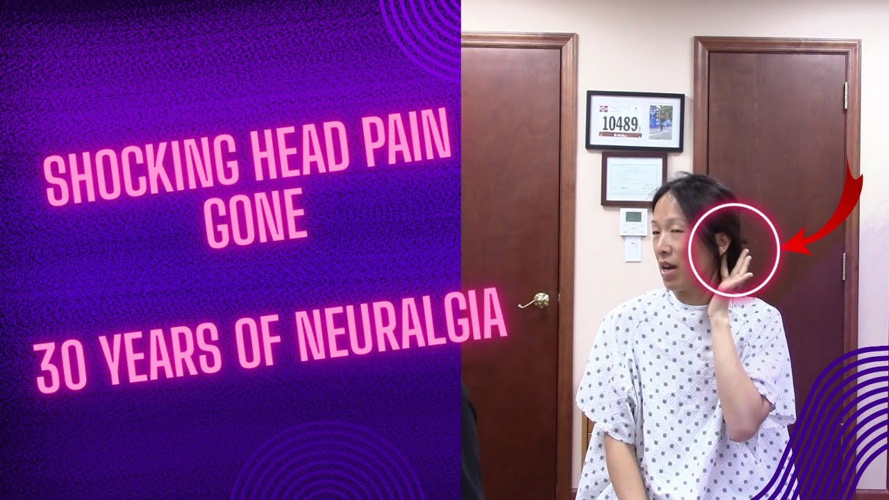 30 Years of Atypical Trigeminal Neuralgia - Shocking Pain Finally Explained & Fixed