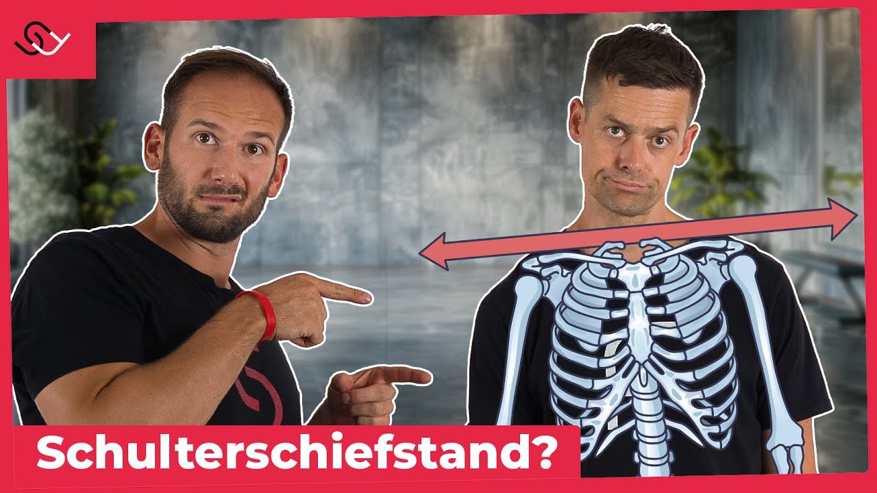 Schulterschiefstand beheben - Mit dieser genialen Übung