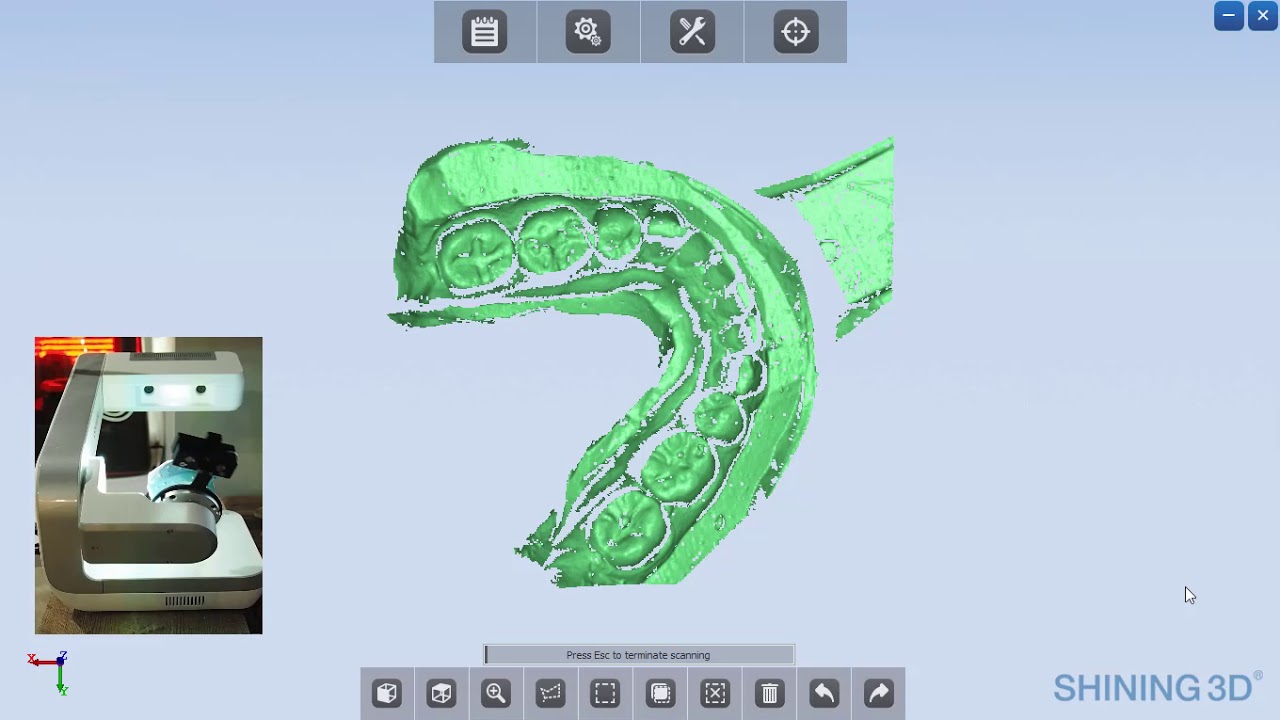 Scanning alginate impressions