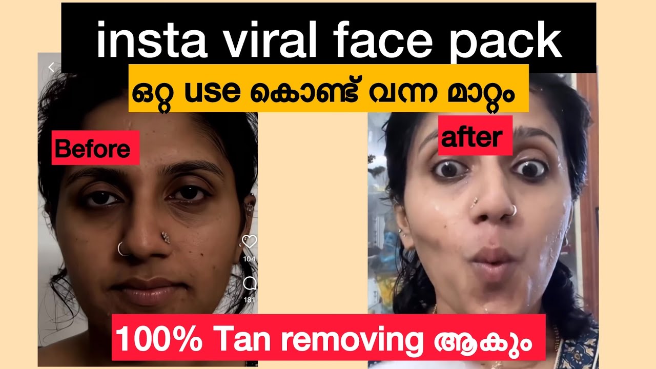 വീട്ടിലെ അടുക്കളയിൽ നിന്നുള്ള 3 സാധനങ്ങൾ കൊണ്ട് മുഖം മൊത്തത്തിൽ tan remove ആക്കാം 