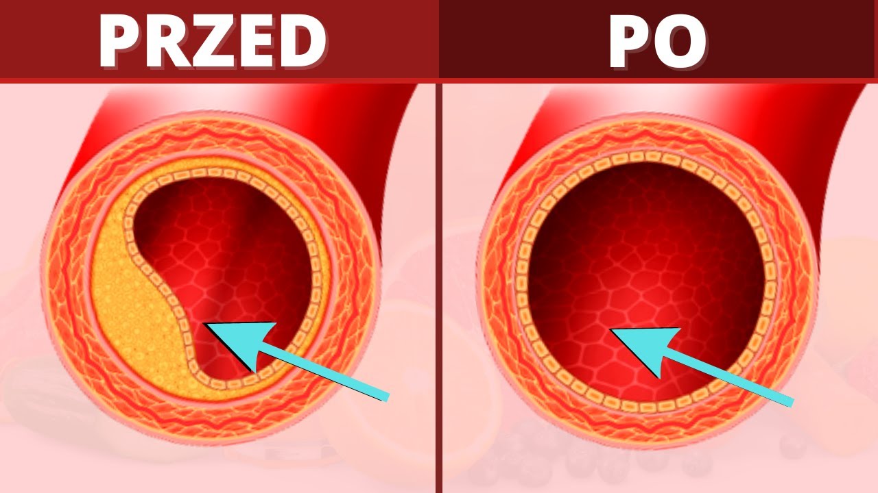 Combine it with VITAMIN C to cleanse your arteries.