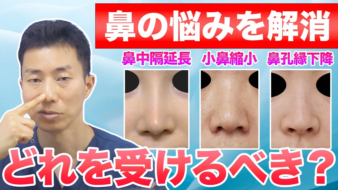 【鼻整形】鼻中隔延長と小鼻縮小と鼻孔縁下降を徹底比較｜自分はどれを受けるべき？