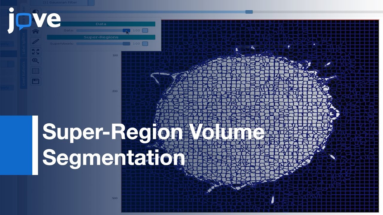 Volume Segmentation & Analysis-Biological Materials Using SuRVoS Workbench l Protocol Preview