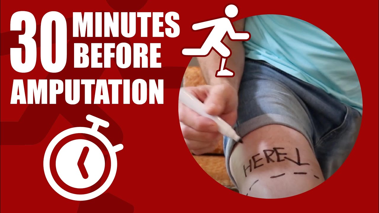 30 Minutes to AMPUTATION