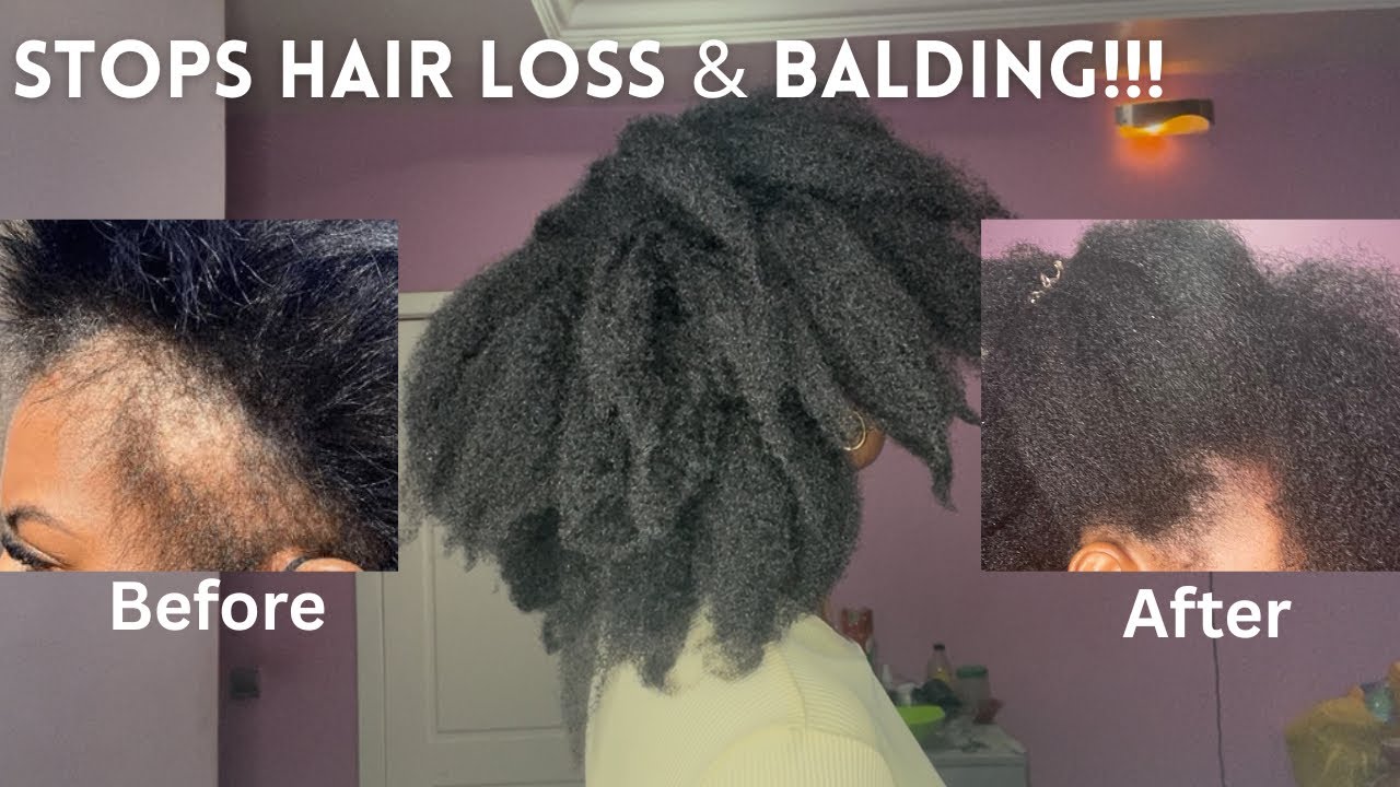 Use This 2 Times a Week and Your Hair Will Never Stop Growing ! Do not WASH this out!