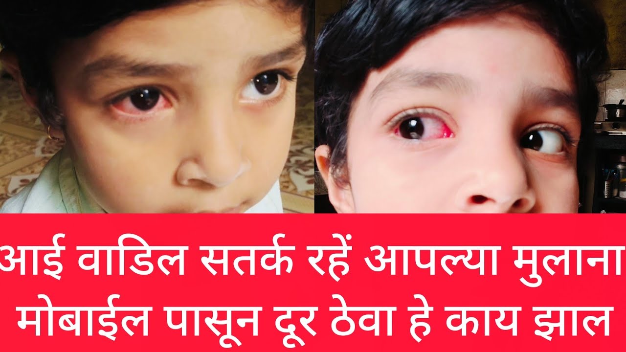 छोटी लेकरनी मोबाईल बाघितल्याने काय होते #आई वडीलानी नक्की पाहा 