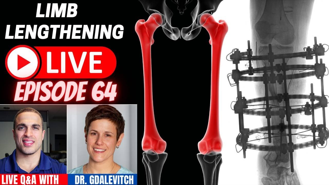 Limb Lengthening LIVE - Episode 64 - LIVE Presentation w/ Dr. Marie Gdalevitch - Montreal, Canada