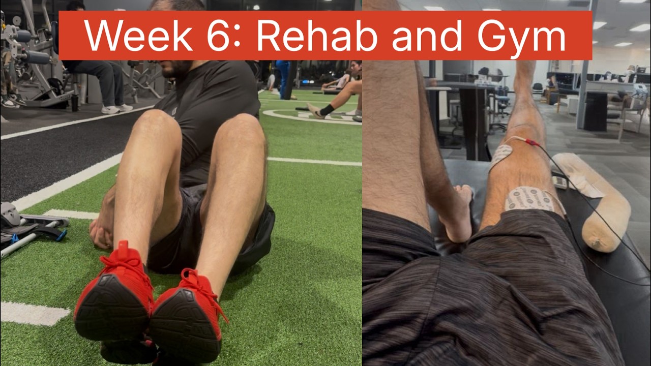 6 недель после операции по восстановлению мениска | Прогресс в разгибании колена и информация от ...