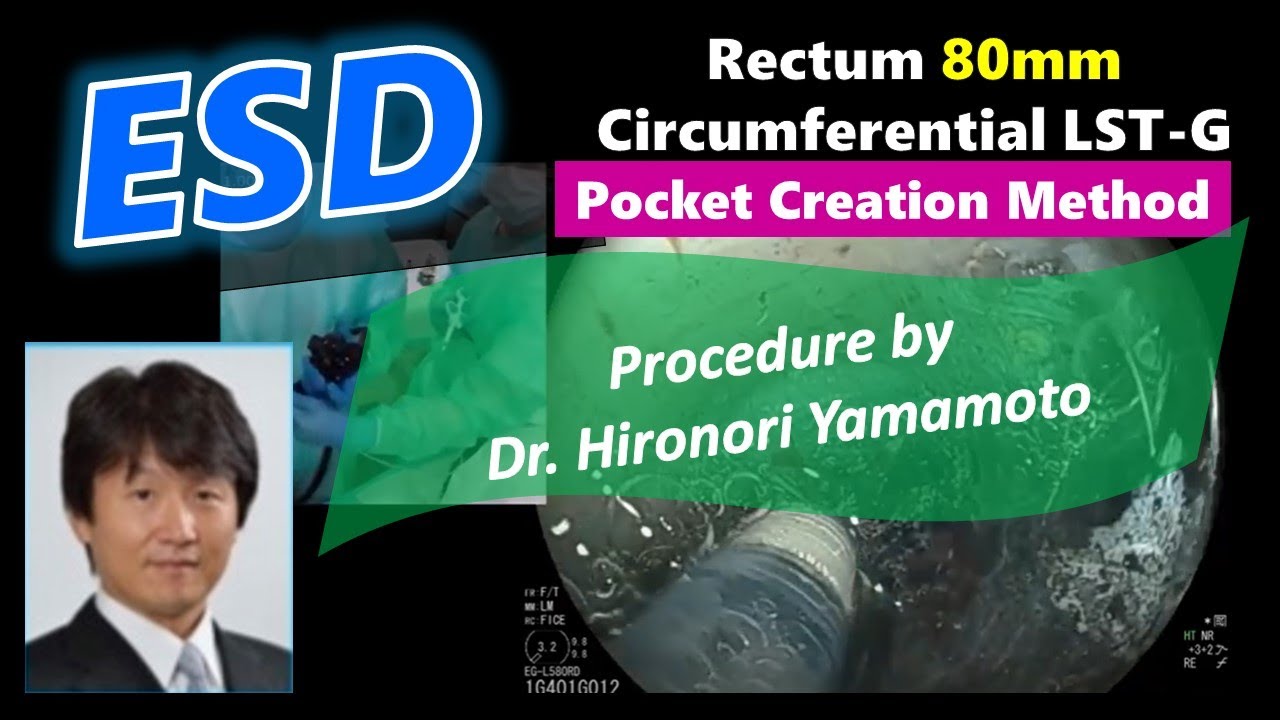 Pocket creation method -Dr. Hironori Yamamoto-
