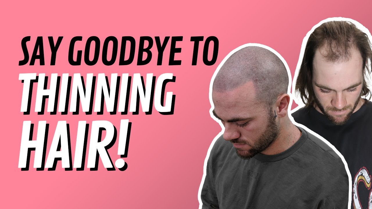 CLIENT TESTIMONIAL VIDEO #1 Hair loss solution. Nathan's Story- Scalp Micropigmentation Australia