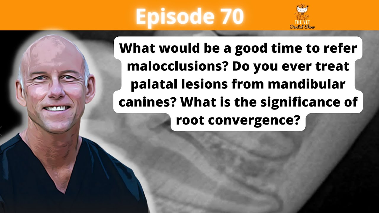 Ep 70 - What would be a good time to refer malocclusions?