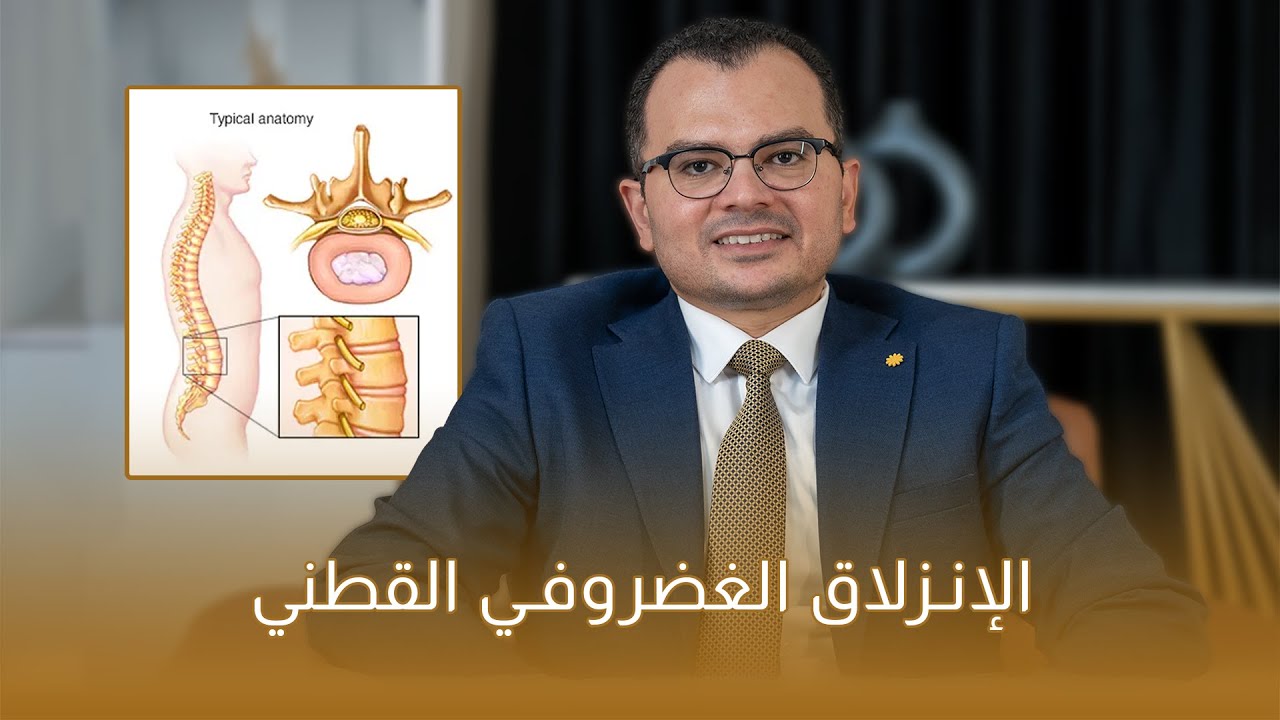 الانزلاق الغضروفي القطني | دكتور محمد الكلاف - إستشاري جراحة المخ والاعصاب والعمود الفقري